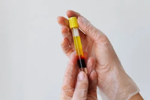 bac water syringe Cyanocobalamin (B12) / Products / American Regent main image 0